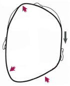 Plagiocefalia Sinostótica